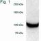 Proteasome 26S Subunit, Non-ATPase 1 antibody, NB120-2941, Novus Biologicals, Western Blot image 