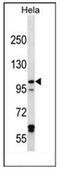Iron Responsive Element Binding Protein 2 antibody, AP52232PU-N, Origene, Western Blot image 