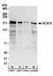 SR-Related CTD Associated Factor 4 antibody, A303-951A, Bethyl Labs, Western Blot image 