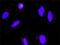E2F Transcription Factor 3 antibody, H00001871-M01, Novus Biologicals, Proximity Ligation Assay image 