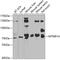 Myotubularin Related Protein 14 antibody, GTX33332, GeneTex, Western Blot image 