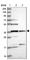 Family With Sequence Similarity 118 Member B antibody, HPA042100, Atlas Antibodies, Western Blot image 