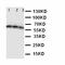 CD40 Molecule antibody, LS-C343861, Lifespan Biosciences, Western Blot image 