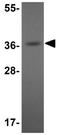 ELOVL Fatty Acid Elongase 7 antibody, GTX85201, GeneTex, Western Blot image 