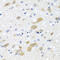 Lecithin-Cholesterol Acyltransferase antibody, 19-222, ProSci, Immunohistochemistry paraffin image 