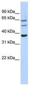 GNT1 antibody, TA329453, Origene, Western Blot image 