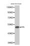 Glucokinase antibody, MBS125319, MyBioSource, Western Blot image 