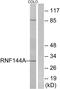 Ring Finger Protein 144A antibody, PA5-39151, Invitrogen Antibodies, Western Blot image 