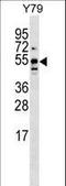 CELF-5 antibody, LS-C159186, Lifespan Biosciences, Western Blot image 