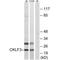 CKLF-like MARVEL transmembrane domain-containing protein 3 antibody, A11481, Boster Biological Technology, Western Blot image 