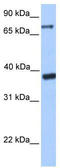 Death-inducer obliterator 1 antibody, TA345359, Origene, Western Blot image 
