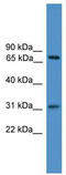 Zinc finger protein 471 antibody, TA345298, Origene, Western Blot image 