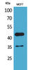 ARP4 antibody, STJ96539, St John