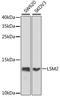 LSM2 Homolog, U6 Small Nuclear RNA And MRNA Degradation Associated antibody, A7988, ABclonal Technology, Western Blot image 