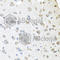 Amyloid P Component, Serum antibody, A1996, ABclonal Technology, Immunohistochemistry paraffin image 