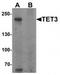 Methylcytosine dioxygenase TET3 antibody, TA320140, Origene, Western Blot image 