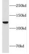 Fibronectin Type III Domain Containing 3A antibody, FNab03176, FineTest, Western Blot image 