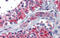 Neuropeptide Y Receptor Y1 antibody, ARP41827_P050, Aviva Systems Biology, Immunohistochemistry paraffin image 