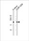 NKG2-C type II integral membrane protein antibody, PA5-72544, Invitrogen Antibodies, Western Blot image 