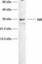 BCL2 Antagonist/Killer 1 antibody, GTX10808, GeneTex, Western Blot image 