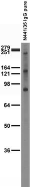 ADAM Metallopeptidase Domain 11 antibody, 75-432, Antibodies Incorporated, Western Blot image 