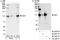 hSIRT1 antibody, A300-687A, Bethyl Labs, Immunoprecipitation image 