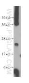 N-alpha-acetyltransferase 11, NatA catalytic subunit antibody, 15670-1-AP, Proteintech Group, Western Blot image 