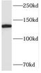 Structural maintenance of chromosomes protein 6 antibody, FNab08020, FineTest, Western Blot image 