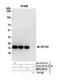 Signal Peptidase Complex Subunit 2 antibody, NBP2-59134, Novus Biologicals, Western Blot image 