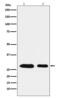 Acidic Nuclear Phosphoprotein 32 Family Member B antibody, M05822, Boster Biological Technology, Western Blot image 
