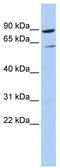 Phospholipase C Delta 1 antibody, TA345145, Origene, Western Blot image 