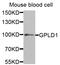 Glycosylphosphatidylinositol Specific Phospholipase D1 antibody, abx005070, Abbexa, Western Blot image 