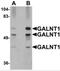 Polypeptide N-Acetylgalactosaminyltransferase 10 antibody, 5281, ProSci Inc, Western Blot image 