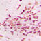PBX/Knotted 1 Homeobox 2 antibody, GTX55970, GeneTex, Immunohistochemistry paraffin image 