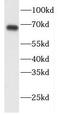 DnaJ Heat Shock Protein Family (Hsp40) Member C1 antibody, FNab02456, FineTest, Western Blot image 