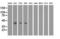 Phosphoribosylaminoimidazole Carboxylase And Phosphoribosylaminoimidazolesuccinocarboxamide Synthase antibody, LS-C115458, Lifespan Biosciences, Western Blot image 