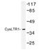 Cysteinyl Leukotriene Receptor 1 antibody, AP01196PU-N, Origene, Western Blot image 