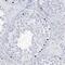 Solute Carrier Family 35 Member A5 antibody, NBP1-83636, Novus Biologicals, Immunohistochemistry paraffin image 