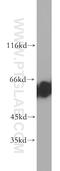 Chromobox 2 antibody, 15579-1-AP, Proteintech Group, Western Blot image 