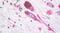 Melanocortin 1 Receptor antibody, PA5-33923, Invitrogen Antibodies, Immunohistochemistry frozen image 