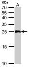 Glutathione S-Transferase Alpha 1 antibody, TA308419, Origene, Western Blot image 