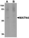 Matrilin 4 antibody, NBP1-77012, Novus Biologicals, Western Blot image 