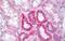 Microtubule Affinity Regulating Kinase 2 antibody, MBS243566, MyBioSource, Immunohistochemistry paraffin image 