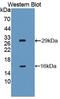 Baculoviral IAP repeat-containing protein 1 antibody, MBS2026928, MyBioSource, Western Blot image 