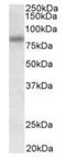 Serologically defined colon cancer antigen 8 antibody, orb12352, Biorbyt, Western Blot image 