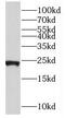 Ribosomal Protein L21 antibody, FNab07420, FineTest, Western Blot image 