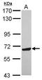 Zinc Finger Protein 587 antibody, GTX119240, GeneTex, Western Blot image 