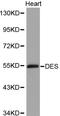 Desmin antibody, LS-C192285, Lifespan Biosciences, Western Blot image 