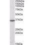Dimethylarginine Dimethylaminohydrolase 1 antibody, orb18846, Biorbyt, Western Blot image 