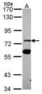 Zinc Finger Protein 74 antibody, GTX114892, GeneTex, Western Blot image 